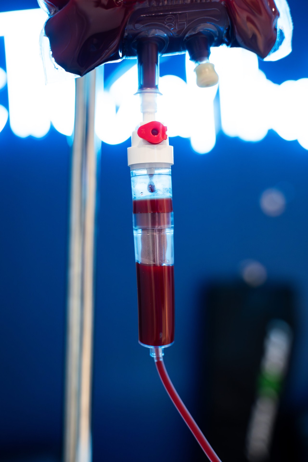 Ozone IV Preparation — Medical-grade ozone prepared for precision IV delivery.