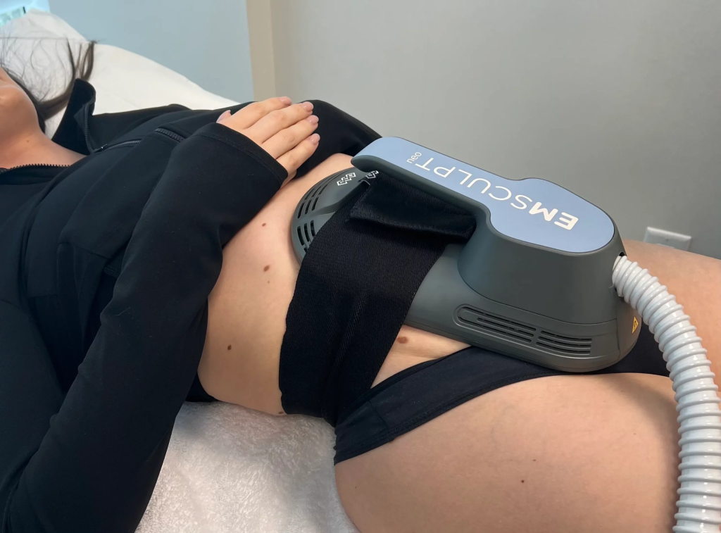Emsculpt Neo session in progress at iCRYO Mauldin
